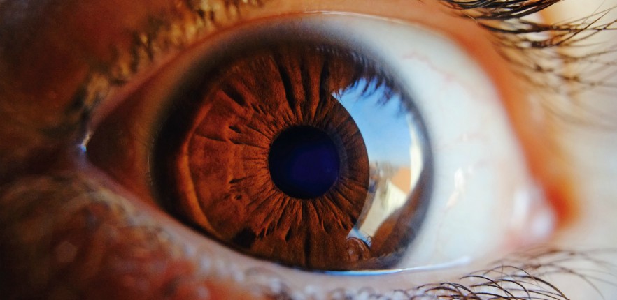 Penyakit Glaukoma Tidak Bisa Dicegah Maupun Diobati Tapi Dapat Diperlambat